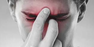 SINUSITE, come riconoscerla, prevenirla e trattarla per evitare peggioramenti